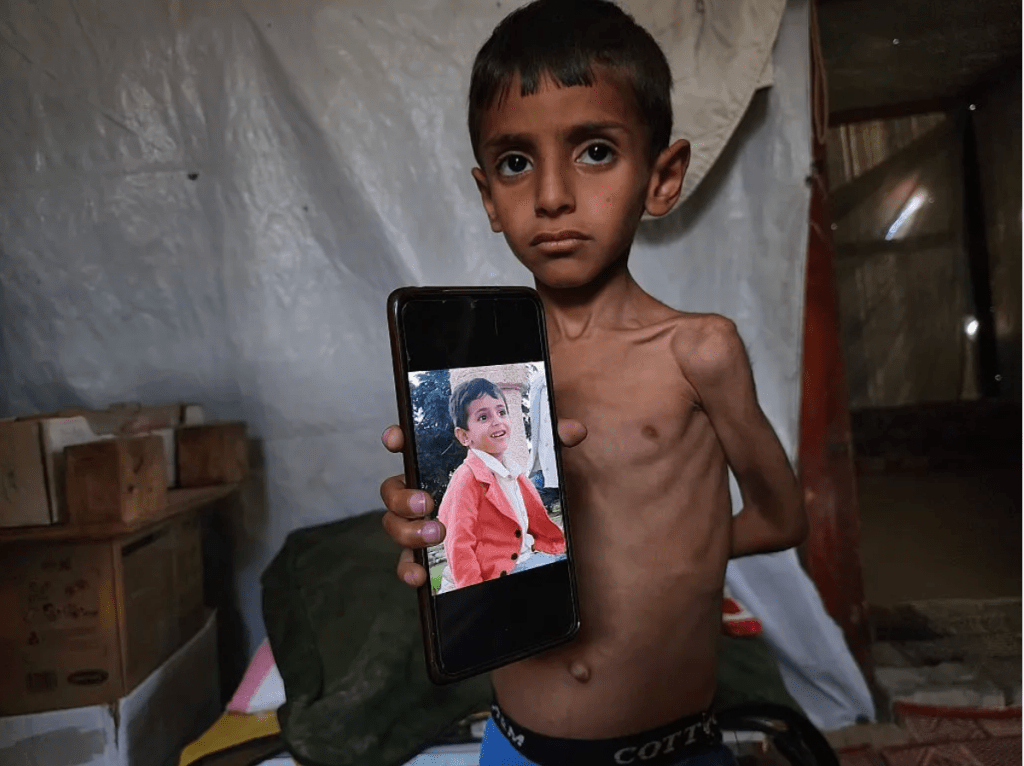 They Became Symbols for Gazan Starvation. But All 12 Suffer from Other Health&nbsp;Problems.